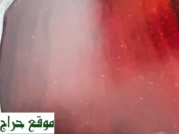 نظام سماعات PSB Imagine الكامل: تجربة صوت سينمائية فاخرة | تاور، سنتر، جانبية | بحالة ممتازة مع الصناديق الأصلية 2