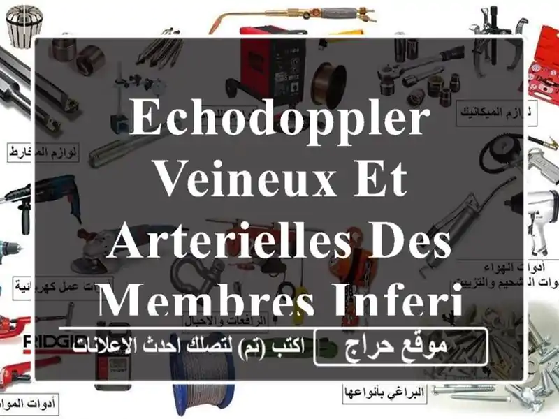 ECHODOPPLER VEINEUX ET ARTERIELLES DES MEMBRES INFERIEURS