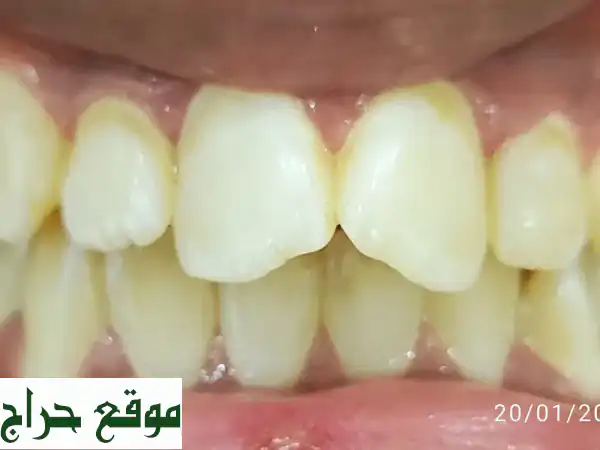 علاج اسنان مدينة الرياض