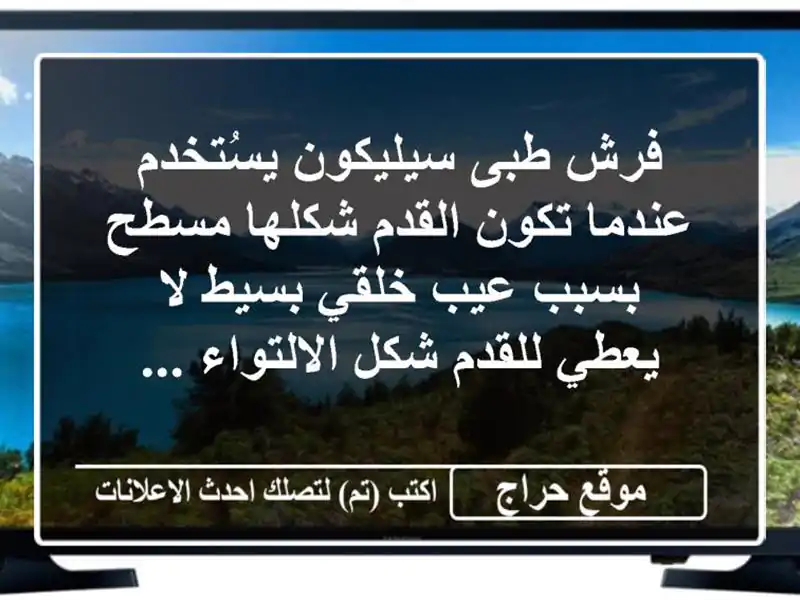 فرش طبى سيليكون يسُتخدم عندما تكون القدم شكلها مسطح بسبب عيب خلقي بسيط لا يعطي للقدم شكل الالتواء ...