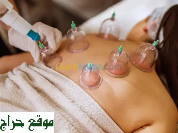 Hijama