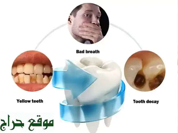 ابتسامة بيضاء ساحرة في دقائق بالسعودية | حل نهائي لاصفرار الأسنان ورائحة الفم