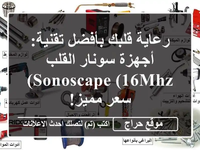 رعاية قلبك بأفضل تقنية: أجهزة سونار القلب Sonoscape (16MHz) -...