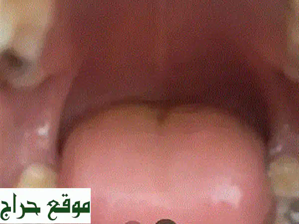 طبيب أسنان رخيص في بيروت | ابتسامة جميلة بسعر مناسب...