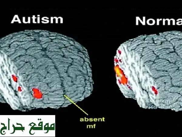 دعم وتوجيه لأطفال طيف التوحد: نحو حياة أفضل...